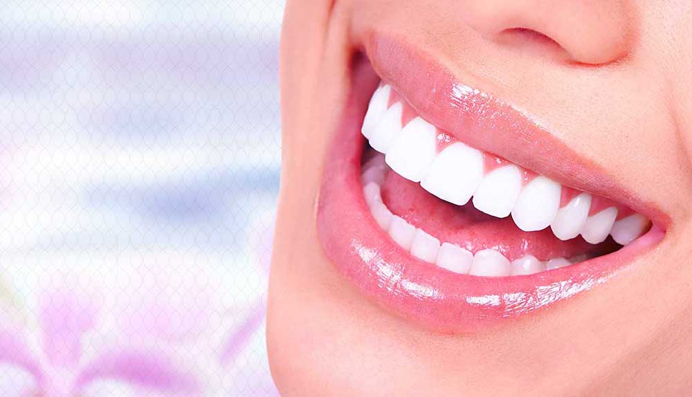 What Is the Purpose of the Hollywood Smile Procedure?